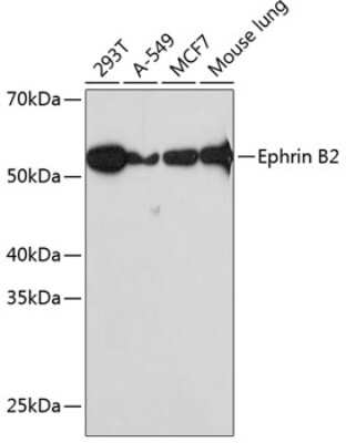 Western Blot: Ephrin-B2 Antibody (1G9E7) [NBP3-15372]