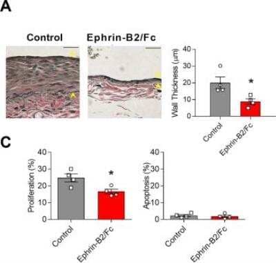 Immunohistochemistry: Ephrin-B2 Antibody [NBP1-49857]