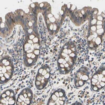 Immunohistochemistry-Paraffin: Ephrin-B2 Antibody [NBP1-84830]