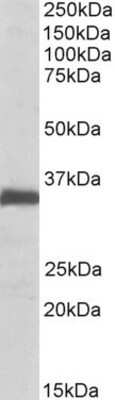 Western Blot: Ephrin-B2 Antibody [NBP1-49857]