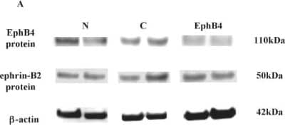 Western Blot: Ephrin-B2 Antibody [NBP1-84830]