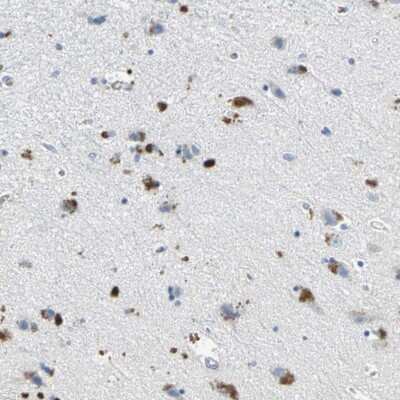 Immunohistochemistry-Paraffin: Ephrin-B3 Antibody [NBP1-84829]