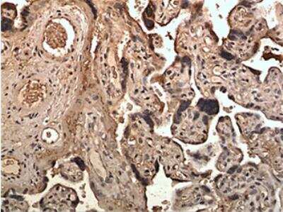 Immunohistochemistry-Paraffin: Ephrin-B3 Antibody (MM0264- 12X1) - Azide and BSA Free [NBP2-12283]