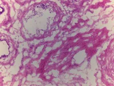 Hematoxylin & Eosin Stain: Epididymis Tissue Slides (Adult Normal)- Frozen [NBP2-77542]