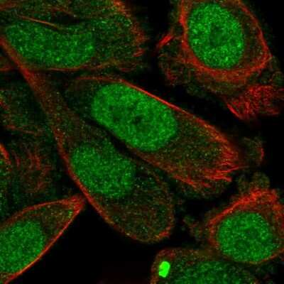 Immunocytochemistry/ Immunofluorescence: Epimorphin/Syntaxin 2 Antibody [NBP2-55283]