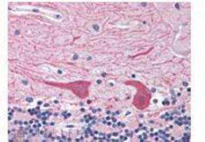 Immunohistochemistry-Paraffin: Epimorphin/Syntaxin 2 Antibody [NBP1-19338]