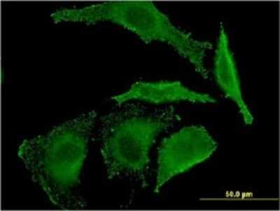 Immunocytochemistry/ Immunofluorescence: Epiregulin Antibody (1E6) [H00002069-M01]