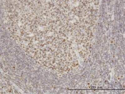 Immunohistochemistry-Paraffin: Epithelial Stromal Interaction 1 Antibody (2A8) [H00094240-M01]