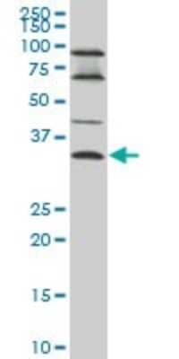 Western Blot: Epithelial Stromal Interaction 1 Antibody (2A8) [H00094240-M01]