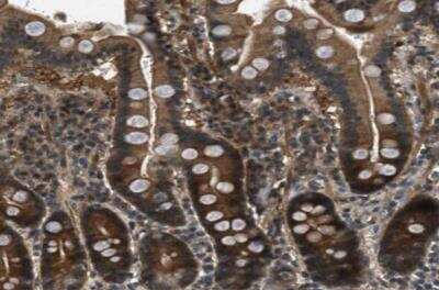 Immunohistochemistry-Paraffin: Epithelial Stromal Interaction 1 Antibody [NBP1-89940]