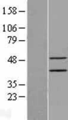 Western Blot: Epithelial Stromal Interaction 1 Overexpression Lysate [NBL1-10305]