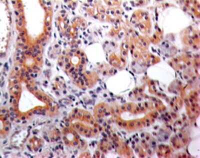 Immunohistochemistry: Eps8 Antibody (18F5B11) - Azide and BSA Free [NBP2-80724]