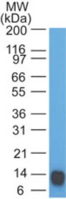 Western Blot: Eps8 Antibody (18F5B11)Azide and BSA Free [NBP2-80724]