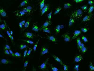 Immunocytochemistry/ Immunofluorescence: Eps8 Antibody [NBP2-97753]