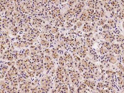 Immunohistochemistry-Paraffin: Eps8 Antibody [NBP2-97753]