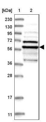 Western Blot: Epsilon 1 Tubulin Antibody [NBP1-85204]