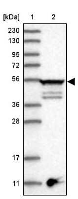 Western Blot: Epsilon 1 Tubulin Antibody [NBP1-85205]