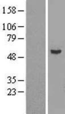 Western Blot: Epsilon 1 Tubulin Overexpression Lysate [NBL1-17443]