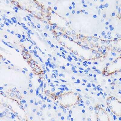 Immunohistochemistry-Paraffin: Epsin 1 Antibody - Azide and BSA Free [NBP3-03439]