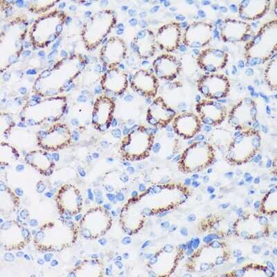 Immunohistochemistry-Paraffin: Epsin 1 Antibody - Azide and BSA Free [NBP3-03439]