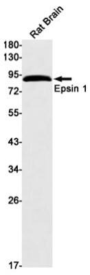 Western Blot: Epsin 1 Antibody (S02-2D1) [NBP3-19625]