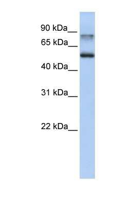 Western Blot: Epsin 1 Antibody [NBP1-56656]