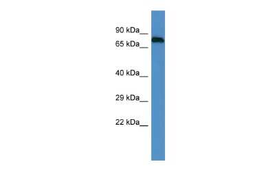 Western Blot: Epsin 1 Antibody [NBP2-87370]