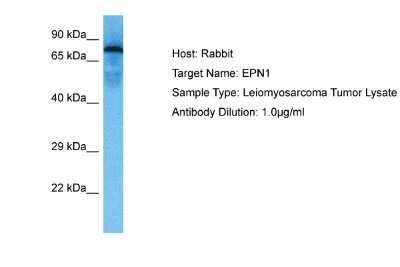 Western Blot: Epsin 1 Antibody [NBP2-87371]