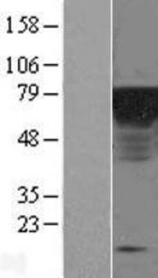 Western Blot: Epsin 1 Overexpression Lysate [NBL1-10297]