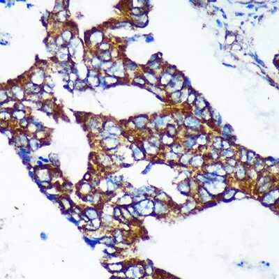 Immunohistochemistry-Paraffin: Epsin-2 Antibody - Azide and BSA Free [NBP3-03347]