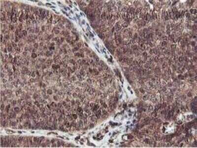 Immunohistochemistry: Epsin-2 Antibody (OTI1G3) - Azide and BSA Free [NBP2-71701]