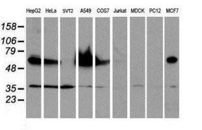 Western Blot: Epsin-2 Antibody (OTI1G3)Azide and BSA Free [NBP2-71701]