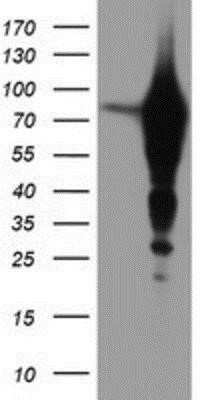 Western Blot: Epsin-2 Antibody (OTI1G3)Azide and BSA Free [NBP2-71701]