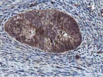 Immunohistochemistry-Paraffin: Epsin-2 Antibody (OTI1G3) [NBP2-01775]