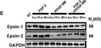 Western Blot: Epsin-2 Antibody [NBP2-16359]