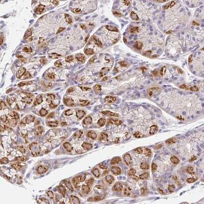 Immunohistochemistry-Paraffin: Epsin 3 Antibody [NBP2-49188]