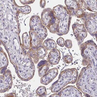 Immunohistochemistry-Paraffin: Epsin 3 Antibody [NBP2-49188]