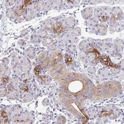 Immunohistochemistry-Paraffin: Epsin 3 Antibody [NBP2-49188]