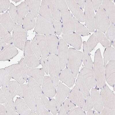 Immunohistochemistry-Paraffin: Epsin 3 Antibody [NBP2-49188]