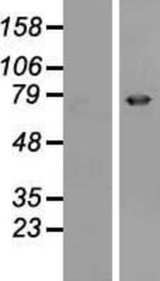 Western Blot: Epsin 3 Overexpression Lysate [NBP2-06890]