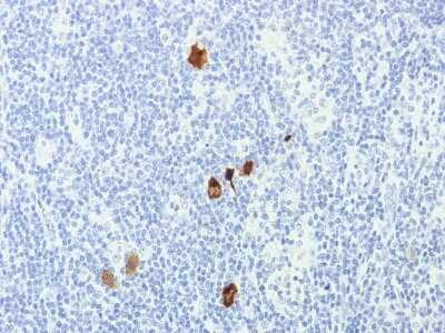 Immunohistochemistry-Paraffin: Epstein Barr Virus Antibody (CS1-4) - Azide and BSA Free [NBP3-08501]