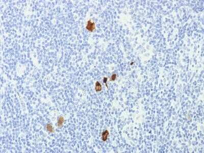 Immunohistochemistry-Paraffin: Epstein Barr Virus Antibody (CS1-4) [NBP3-07676]