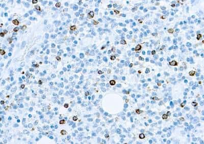 Immunohistochemistry-Paraffin: Epstein Barr Virus Antibody (CS1, CS2, CS3, CS4) [NB120-17085]