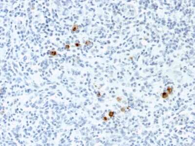 Immunohistochemistry-Paraffin: Epstein Barr Virus Antibody (CS4) - Azide and BSA Free [NBP3-08449]