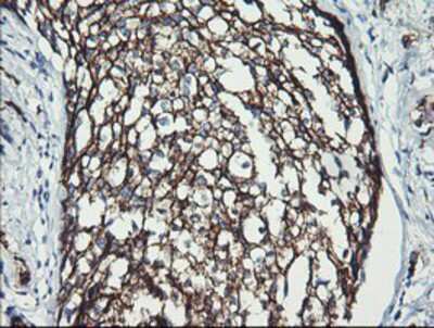 Immunohistochemistry-Paraffin: ErbB2/Her2 Antibody (OTI4F10) [NBP2-01152]
