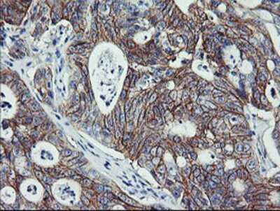 Immunohistochemistry-Paraffin: ErbB2/Her2 Antibody (OTI4F10) [NBP2-01152]