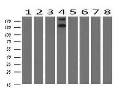 Western Blot: ErbB2/Her2 Antibody (OTI4F10) [NBP2-01152]