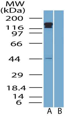 Western Blot: ErbB2/Her2 AntibodyBSA Free [NBP2-29624]