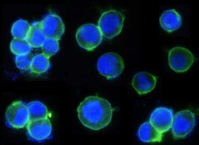 Immunocytochemistry/ Immunofluorescence: ErbB2/Her2 Antibody (002) [NBP2-89184]