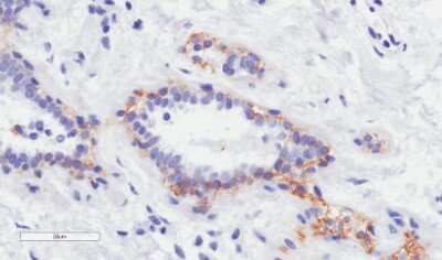 Immunohistochemistry-Paraffin: ErbB2/Her2 Antibody (4D5-8 (trastuzumab)) - Chimeric - Azide and BSA Free [NBP2-52639]